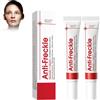 Junjie Crema sbiancante correttore,Crema sbiancante contro le macchie scure sul viso, creme per la rimozione di macchie di pigmento viso, crema sbiancante per tutti i tipi di pelle (2)