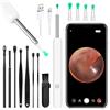 ACWOO Otoscopio, Pulisci Orecchie con Telecamera, 1296P HD Orecchie Pulizia Orecchie Rimozione Cerume con 6 Luci LED, WIFI Pulizia Orecchie Otoscopio per iPhone, iPad e Android