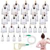 Halorin Set di 32 coppette per terapia tradizionale cinese e massaggio coppettazione, set di coppette con pompa per vuoto e tubo di prolunga per coppettazione, set (senza olio)