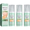 Lovelycat Post Acne Trattamento spray Post Acne spray Post Acne Saliva spray Body Acne spray Post Acido Saliva spray (3PC-3)