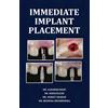 Dr Aadarsh Dhan Immediate Implant Placement (Tascabile)