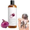 Generico Shampoo Al Rosmarino E Cipolla Rossa, 200 Ml Shampoo Rinforzante E Nutriente Con Estratti Vegetali Per Capelli Dall'aspetto Più Folto, Detergente Quotidiano Per Donne E Uomini