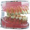 Mayhug Denti falsi modellabili, protesi dentarie finte, modello di denti per impianto dentale, con gomma morbida e denti estraibili in resina rimovibili per pratica e insegnamento