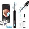 Bebird Pro BebirdPro Rimuovi Cerume Otoscopio R1, Pulitore per Orecchie con Fotocamera 1080P HD, Otoscopio con Luce, Otoscopio Grandangolare IP67 Impermeabile per Adulti, Bambini, iOS, Android