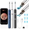SUNUO Pinzette per orecchie 3 in 1 abilitate Wi-Fi Strumento per la rimozione del cerume con fotocamera da 12 MP con batteria ricaricabile Detergente per orecchie con pinzette Strumenti
