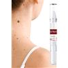 Generico Penna per la rimozione della verruca da 3 ml Penna per la rimozione della talpa della pelle rapida Prodotti per la cura della bellezza del viso naturale