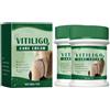 GNAUMORE Crema Per Vitiligine, Crema Lenitiva Per La Vitiligine,Cremas Per La Cura Della Vitiligines,Rimuove Le Macchie Bianche 3PC
