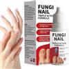 Generico Cura Unghie Naturale - Rinforzante Unghie | Soluzione Riparazione Delicata 15ML - Cura Cuticole per Preparazione Manicure e Pedicure Domestica