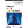 VK Arora Kamal Chopra Update on MDR Tuberculosis (Tascabile)