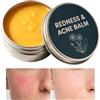 Generisch Crema Idratante Lozione Lisciante, Umettante, Lenitiva e Rinfrescante | Crema Facciale per Viso Lenitivo Idratante Quotidiano da Viaggio Uomo Donna