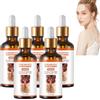 VKaoess Siero schiarente per la pelle - Siero per il trattamento dell'iperpigmentazione - Siero correttore delle macchie scure per viso e corpo - Trattamento schiarente con niacinamide, 50 ml (5 bottiglie)
