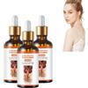 VKaoess Siero schiarente per la pelle - Siero per il trattamento dell'iperpigmentazione - Siero correttore delle macchie scure per viso e corpo - Trattamento schiarente con niacinamide, 50 ml (3 bottiglie)