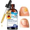 nailpretty 30ml Liquido Riparatore Cura delle unghie, Oli per la cura unghie incarnite, Smalto Curativo, Facile e Rapido, Senza Scolorire l'Unghia