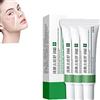 ZMMQ Whitening Freckle Cream,Acne Scar Removal Treatment Cream,Pigmentation Removal Cream For Face,Remove Melasma Acne Cream Fading Spot Cream,Dark Spot Corrector For Face (Acne Relief-3PCS)