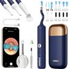 Bebird Pro BebirdPro - Estrattore di cerume Earsight Plus, 1920P, HD regolabile, con fotocamera, otoscopio con luce, pulitore per le orecchie con scatola portatile per adulti, bambini, iOS, Android