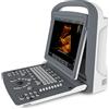 CHISON ECOGRAFO CHISON ECO2 B/N - 1 connettore sonda