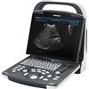 MINDRAY ECOGRAFO MINDRAY DP-10 - portatile - con monitor LED 12.1"