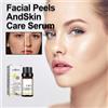 eelhoe Siero Peeling Viso 7HT con Acido Malico e Acido Citrico 50% - Siero Esfoliante Chimico Sbiancante e Nutriente