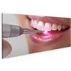 islandburner Quadro su tela sbiancante dei denti con tecnologia LED dal dentista per il bagno paziente studio dentistico Immagini da parete Poster