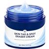 Generico Crema Per Eliminare Le Macchie Della Pelle Burro Per Rimuovere Le Macchie | Eliminatore Di Imperfezioni Della Pelle Adatto A Uomo, Donna E Giovani Per Schiena, Spalle, Collo, Ascelle, Bracci