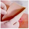 SMITH & NEPHEW SRL Smith & Nephew Medicazione Idrocellulare Sterile Altamente Assorbente Non Adesiva In Schiuma Di Poliuretano 10x10cm 3 Pezzi