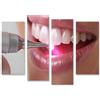 islandburner Quadro su tela sbiancante dei denti con tecnologia LED dal dentista per il bagno paziente studio dentistico Immagini da parete Poster