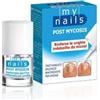 My nails post mycosis 5 ml - - 927092472