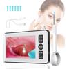 NONE Otoscopio Digitale con Schermo HD da 4,3 Pollici, Kit per la Rimozione del Cerume con Telecamera, Endoscopio Auricolare da 3,9 mm per Adulti e Bambini