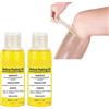 ZMMQ 1/2/3PCS Super Strength Yellow Peeling Oil Exfoliating Dark Skin For Body, Strong Yellow Peeling Oil Lighten Elbows Knees Hands Melanin Even Skin Tone And Whitening Skin (30ML 2PC)