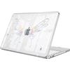 FINTIE Cover Compatibile con MacBook Neo 13 Pollici A3404 (A18 Pro, 2026) | Ultra Sottile Trasparente Custodia Rigida Protettivo Guscio Rigido Case per MacBook Neo 13", Glitter Farfalla Meteora