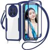 FERLAN Cover per Honor Magic 8 Pro 5G con Cordino, 360 Gradi Antiurto Custodia con Protezione Schermo Integrata Trasparente Rugged TPU Bumper Doppia Protettiva Cover per Honor Magic 8 Pro 5G -Blu