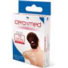 CEROXMED Cerotto per sutura ceroxmed 3x75 mm 10 pezzi - CEROXMED - 921395556