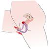 Diffusore intimo viola 1 St