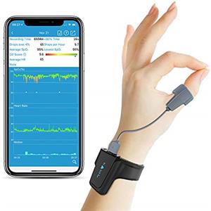Viatom Sleep Oxygen Tracker con notifica a vibrazione e rapporto PC per apnea notturna e del sonno, Saturimetro da polso Bluetooth, Mate perfetto per CPAP Machine