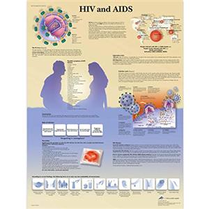 3B Scientific VR1725L Anatomia Umana - Grafico HIV e AIDS, versione Laminata